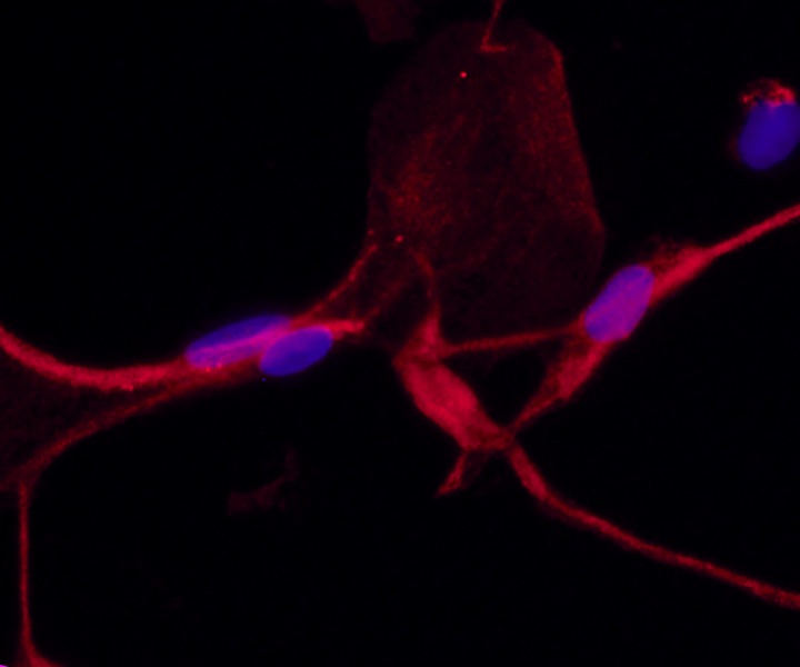 mature fibrocytes