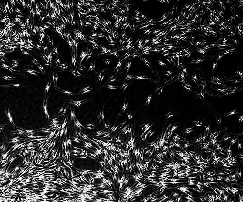 cells closing a wound gap