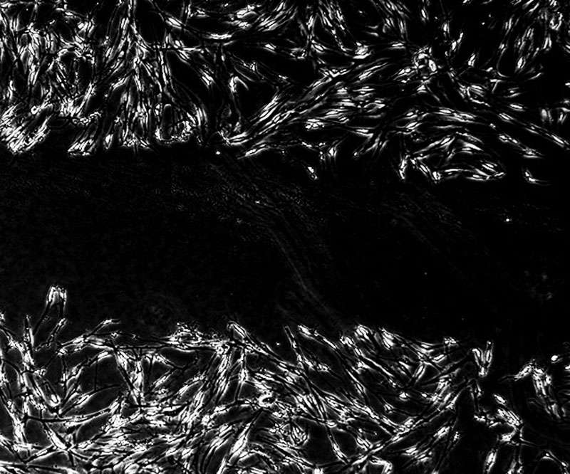 blocked CXCL8 disrupts cell recuitment