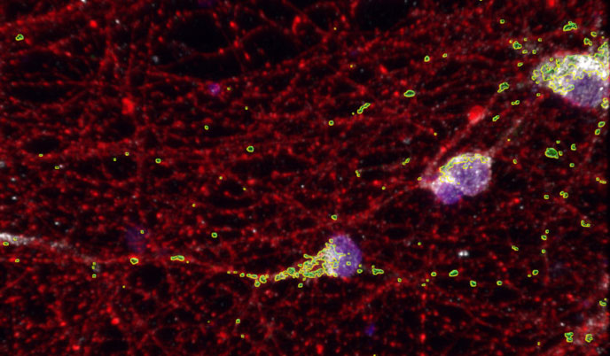 A dense spiderweb-like network of red lines punctuated by glowing spots of green and purple