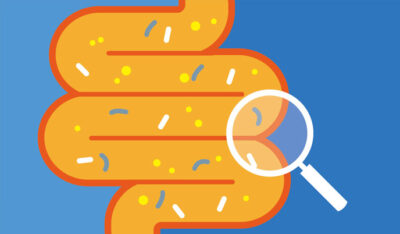 Large intestine illustration