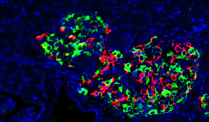 pancreatic cells