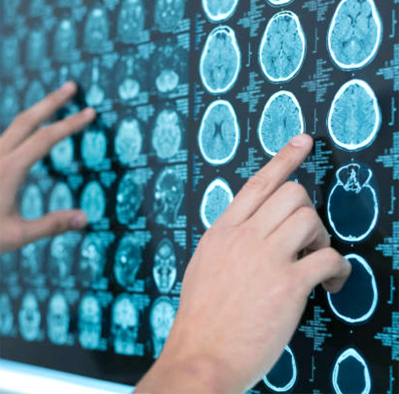 A person reviews brain scans