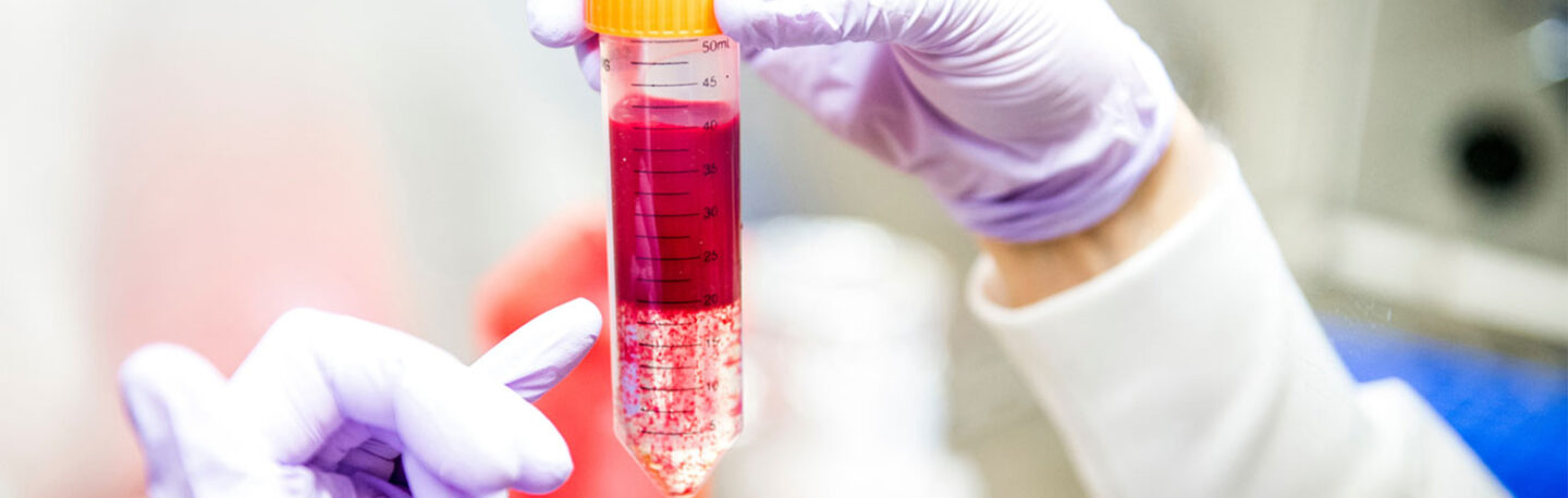 A scientist examines a vial containing a red substance floating to the top of clear liquid