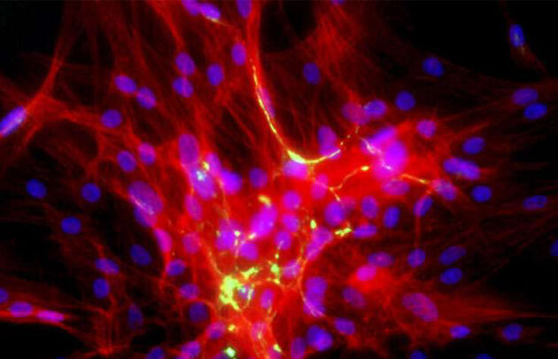 color image of cluster of cells actively migrating to help close a wound