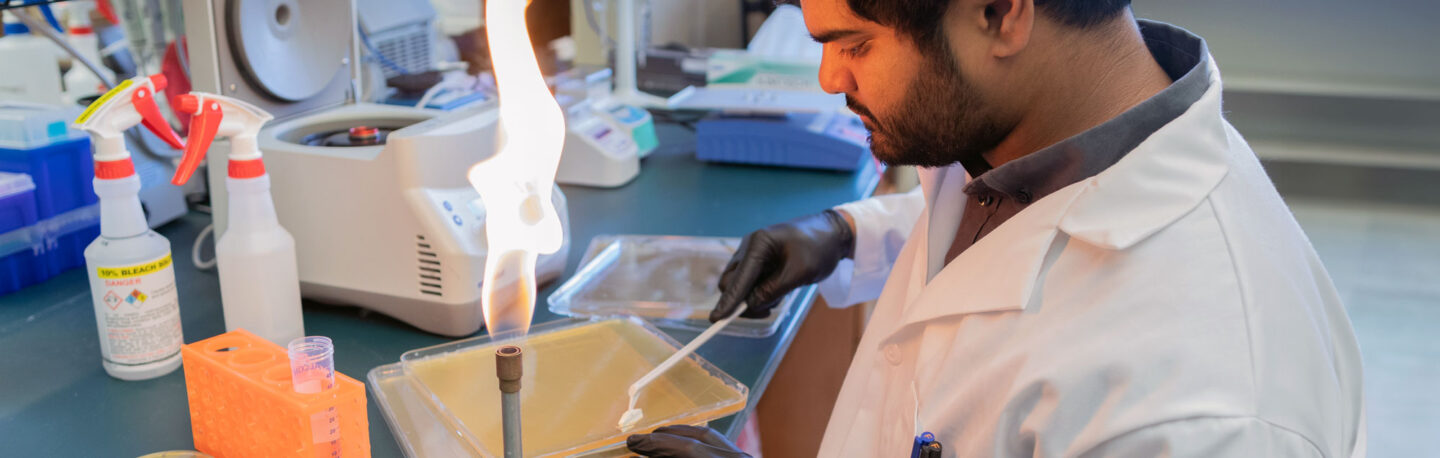 A researcher working with an open flame in a lab