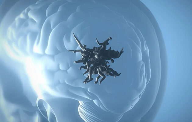 A tangle of black tube-like forms superimposed over a human brain