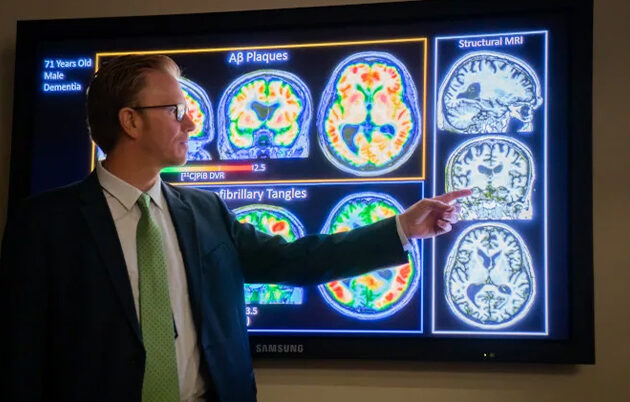 A man examines scans from a WRAP study participant.