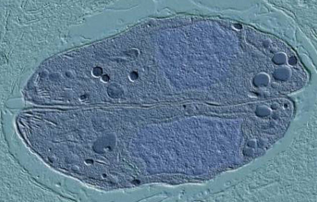 Microscopic image of parasite Toxoplasma gondii