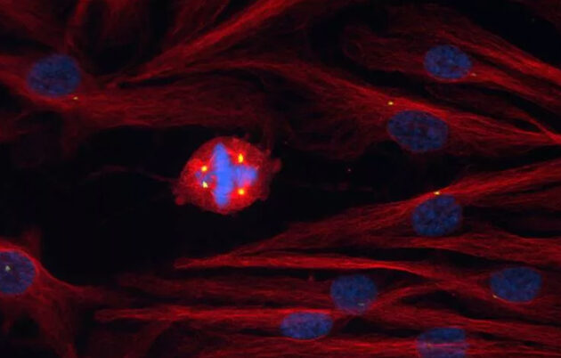 dividing cells and chromosomes under a microscope