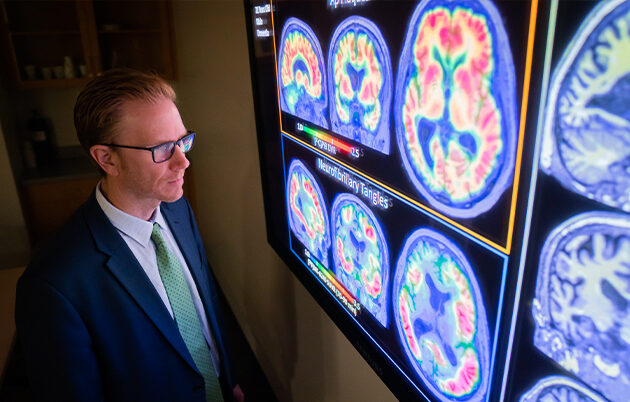 A man analyzing brain scans.