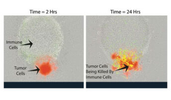 Immune cells and tumor cells at 2 hours and 24 hours