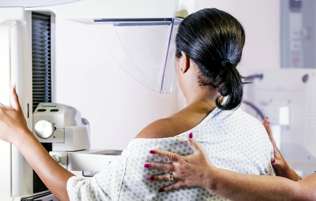 Woman standing at a mammography machine