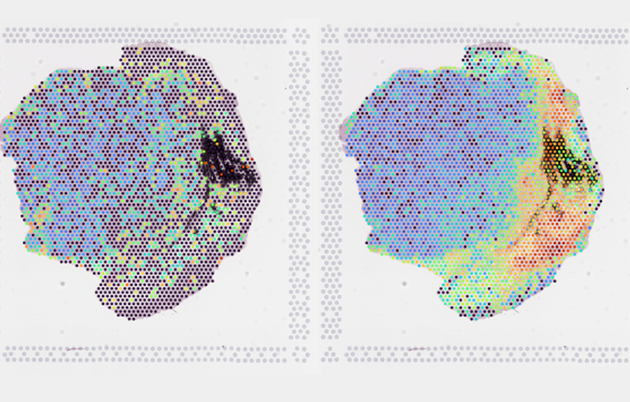 imaging of variable radiation dosage and variable tissue response