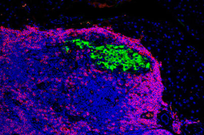 An immunofluorescence image of pancreatic cells and immune cells in mice.