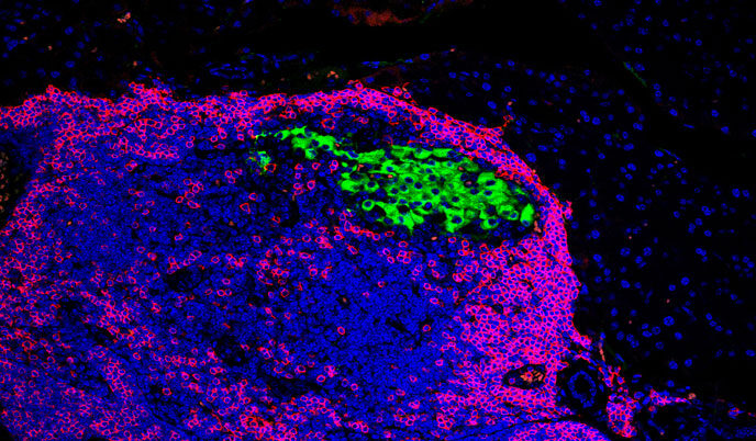 An immunofluorescence image of pancreatic cells and immune cells in mice.