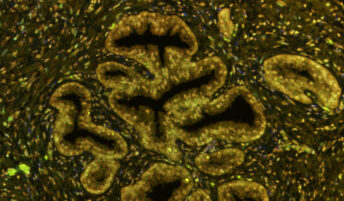 microscope image from prostate cancer trial testing