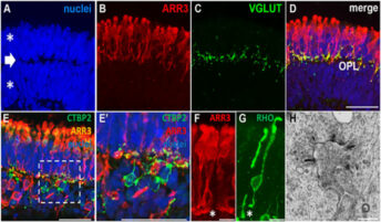 Retinal Organoids Derived from Human Pluripotent Stem Cells Recapitulate in Vivo Outer Retina