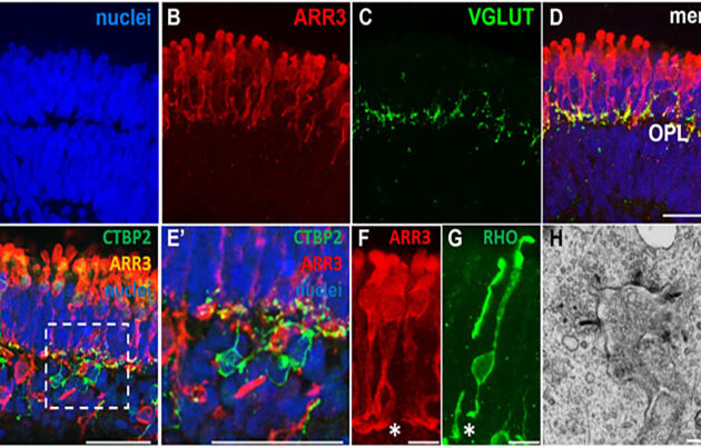 Retinal Organoids Derived from Human Pluripotent Stem Cells Recapitulate in Vivo Outer Retina