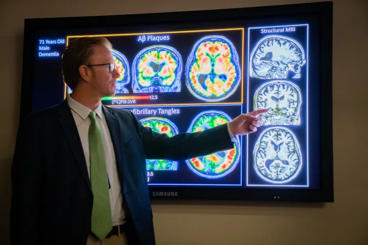 A professional examines different brain scans